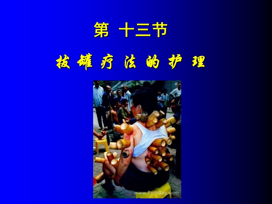 《拔罐疗法的护理》PPT课件.ppt_第1页