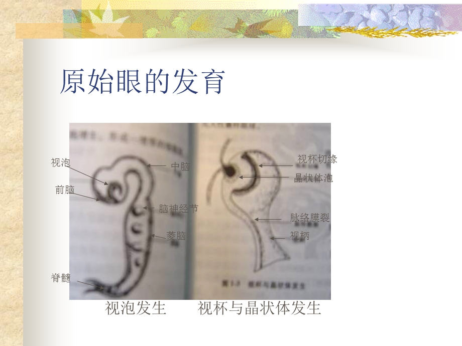 眼的胚胎发育.ppt_第3页