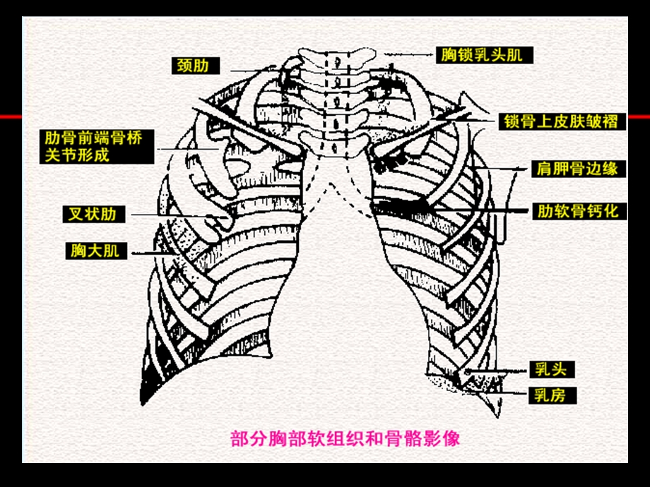 《胸片阅读必看》PPT课件.ppt_第3页