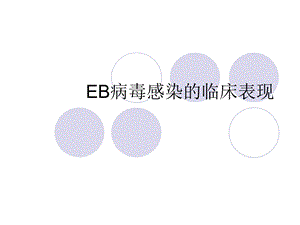 EB病毒感染的临床表现.ppt