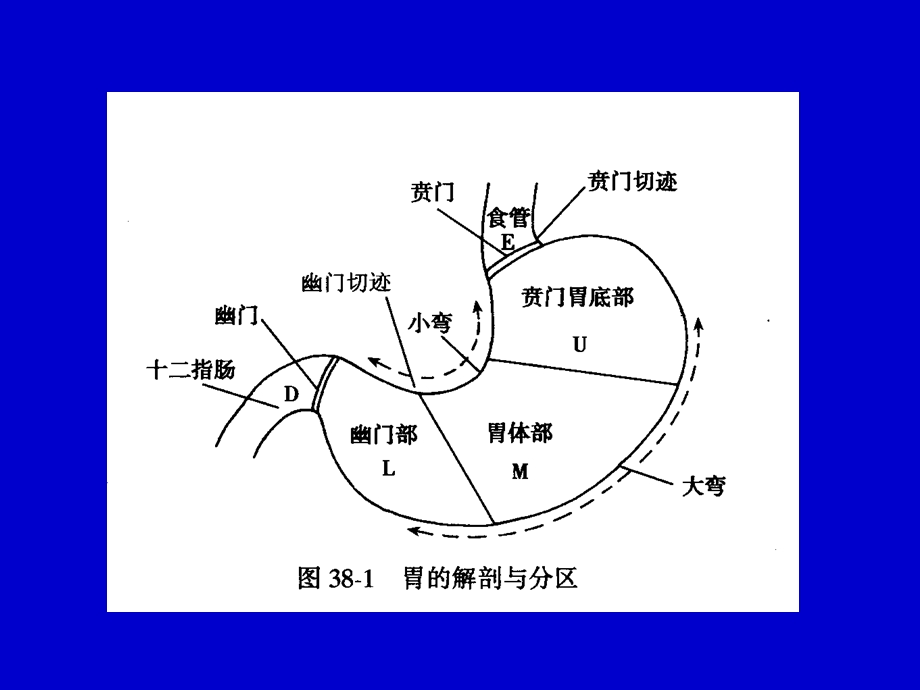 胃十二指肠溃疡幻灯.ppt_第3页