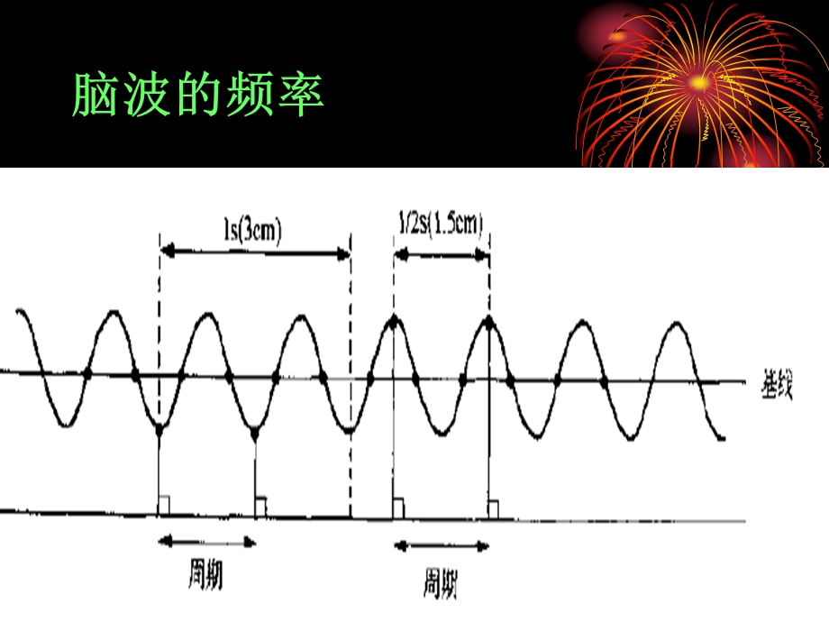 《脑电图基本入门》PPT课件.ppt_第3页