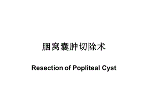 胭窝囊肿切除术.ppt