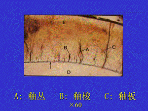 牙本质牙髓牙骨质课件!!!.ppt