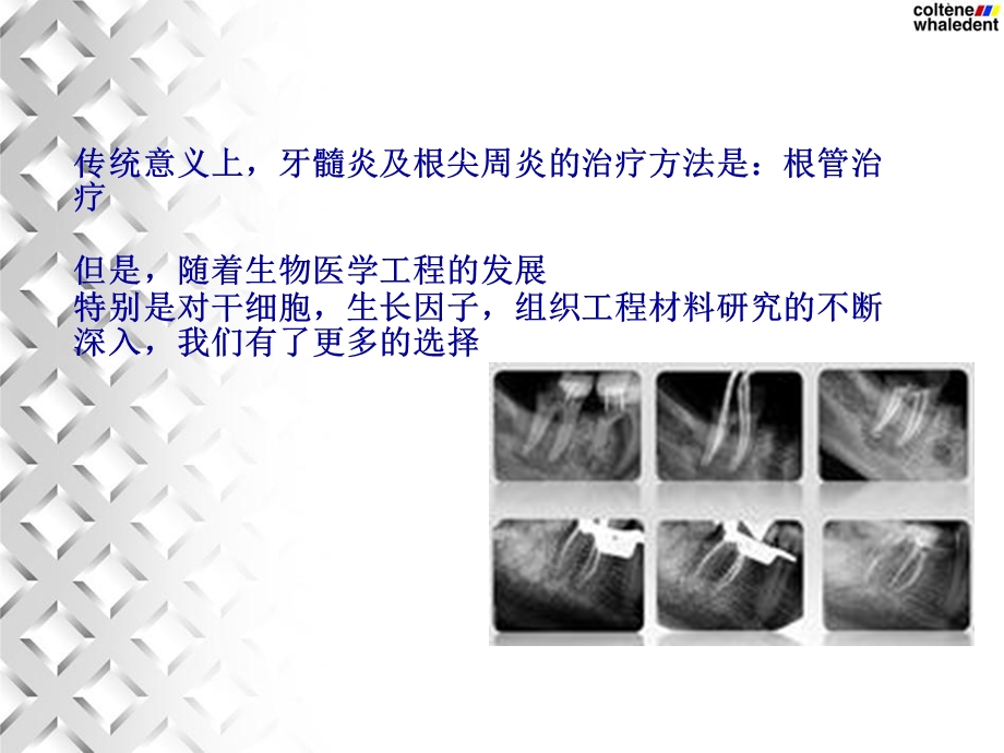 《牙髓血运重建术》PPT课件.ppt_第2页