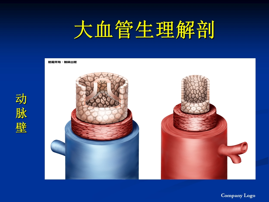 主动脉夹层护理罗湘玉1022.ppt_第3页