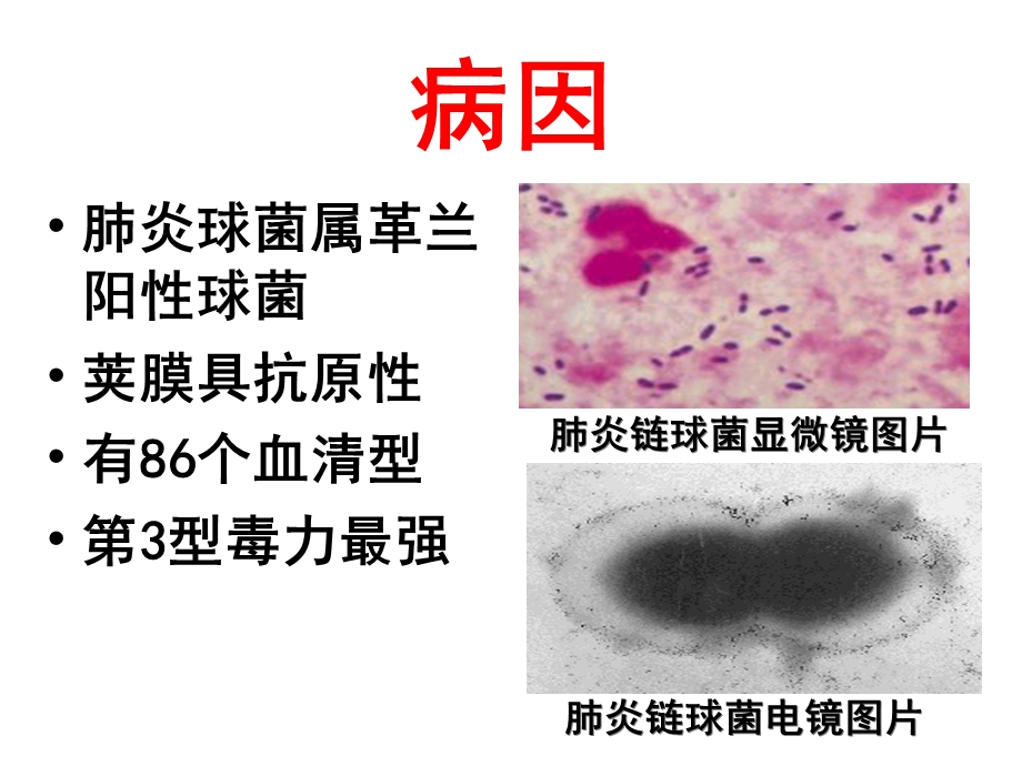 《细菌性肺炎》PPT课件.ppt_第3页