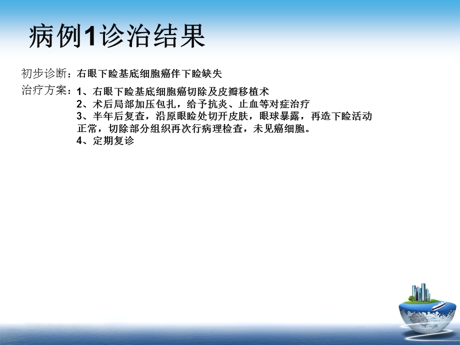 眼睑基底细胞癌.ppt_第3页