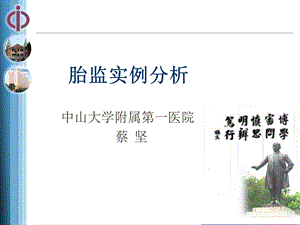 《胎监实例分析》PPT课件.ppt