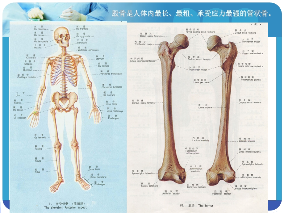 《股骨骨折护理》PPT课件.ppt_第3页