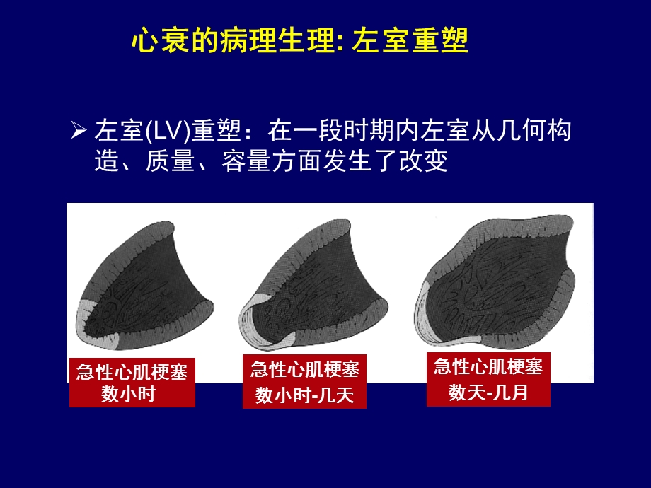 ACS合并心衰患者临床结局和抗血小板治疗.ppt_第3页