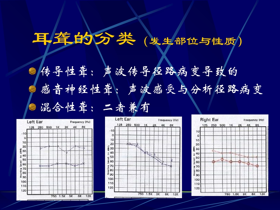 《耳聋与眩晕》PPT课件.ppt_第3页