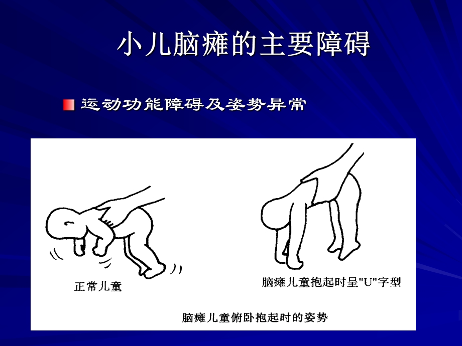 苏州残联培训脑瘫评估与训练.ppt_第3页