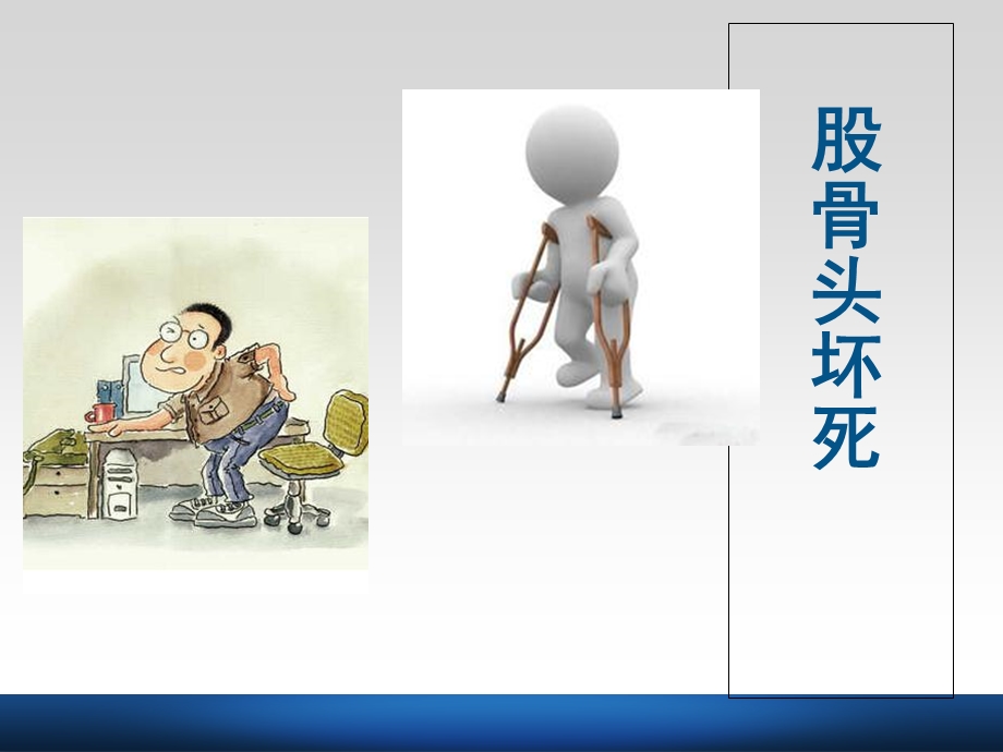 《股骨头坏死》PPT课件.ppt_第2页