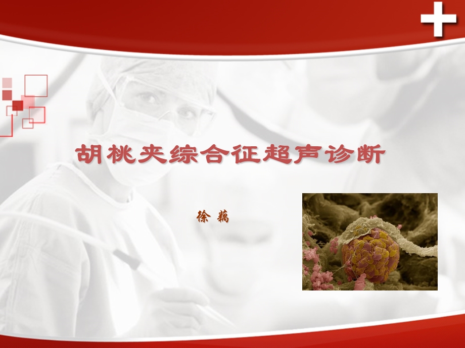 《胡桃夹综合征》PPT课件.ppt_第1页