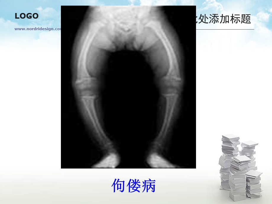 食物中的营养物质2课件.ppt_第3页