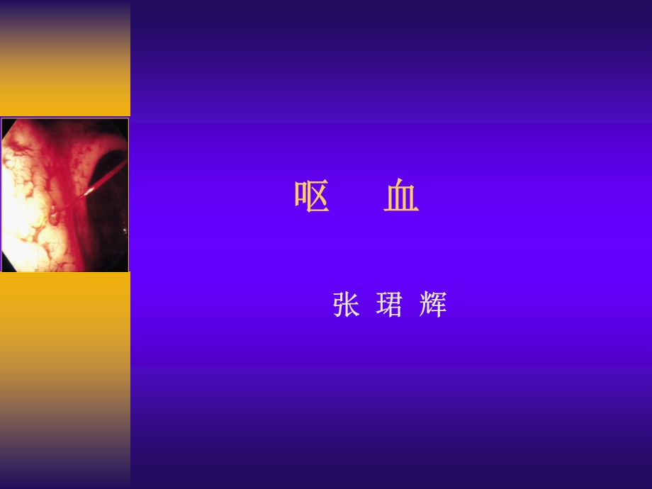 《腹痛呕血便血临本》PPT课件.ppt_第1页