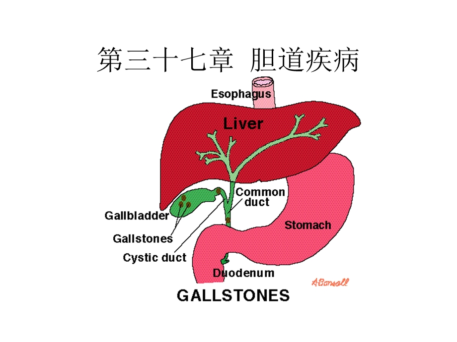 《胆道疾病学习》PPT课件.ppt_第1页