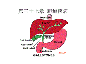 《胆道疾病学习》PPT课件.ppt