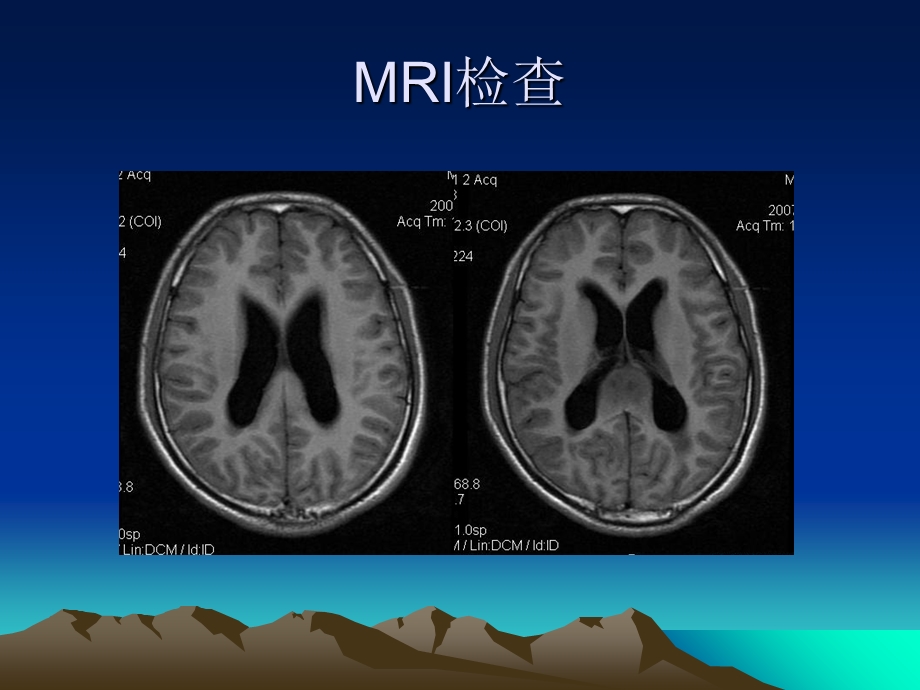 《病例随访汇报》PPT课件.ppt_第3页