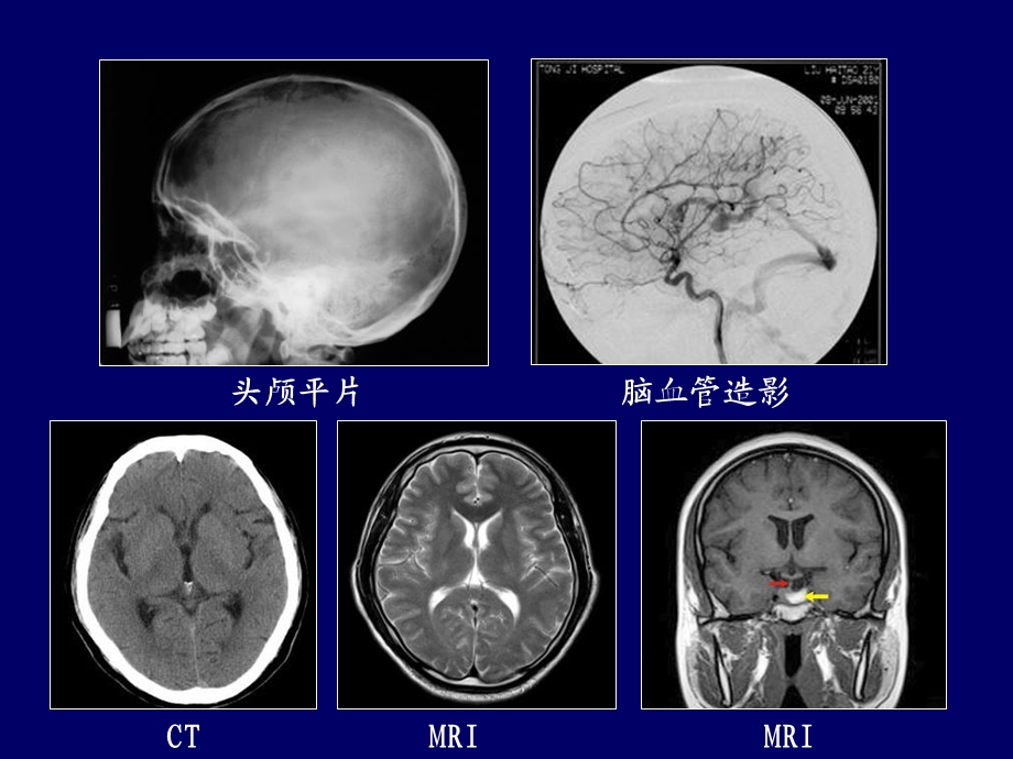 《神经影像学》PPT课件.ppt_第3页