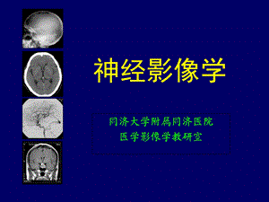 《神经影像学》PPT课件.ppt