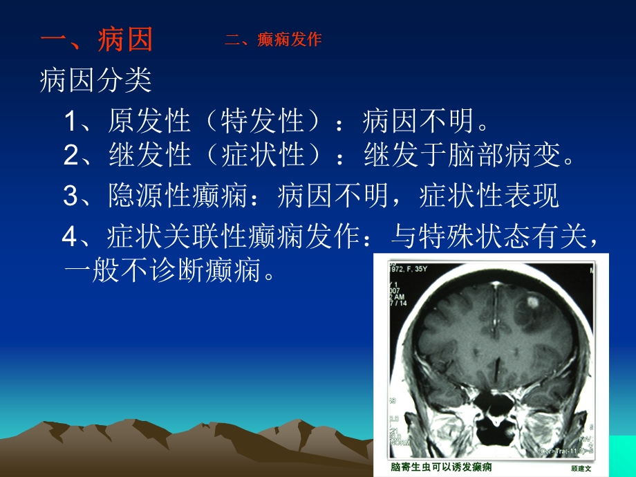 《癫痫多种病因》PPT课件.ppt_第1页