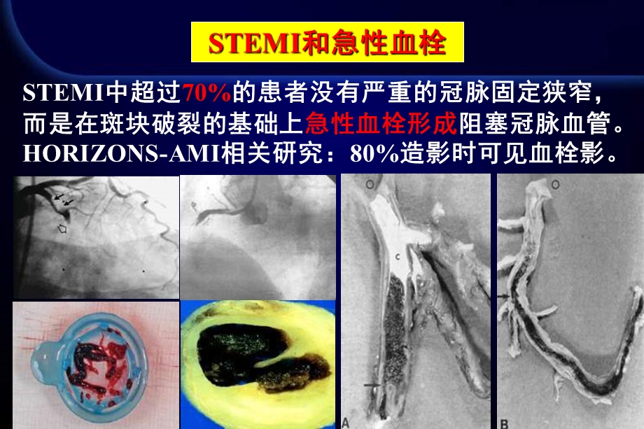 邢台市人民医院魏庆民.ppt_第2页