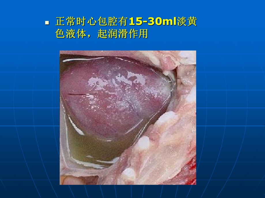 《精品心包积液》PPT课件.ppt_第3页