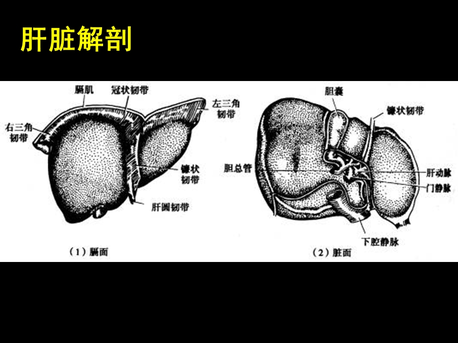 《肝脏外科护理》PPT课件.ppt_第3页