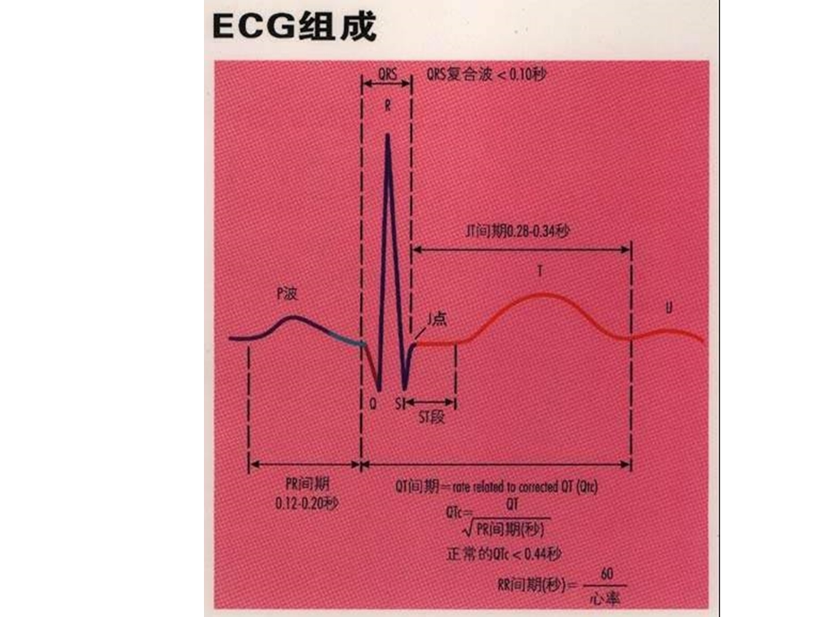 《看图识心电》PPT课件.ppt_第2页