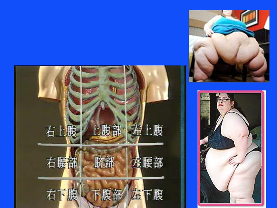 《腹部体征》PPT课件.ppt_第2页