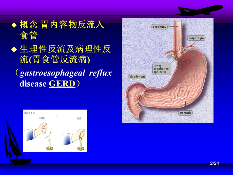 胃食管反流.ppt_第2页