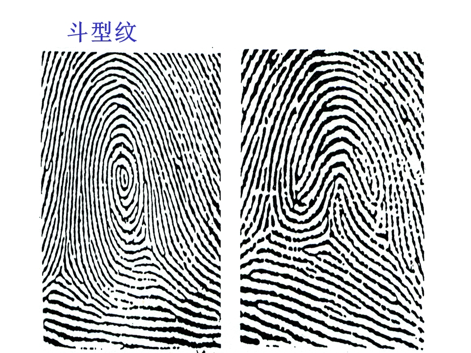 《指纹类型专训》PPT课件.ppt_第3页
