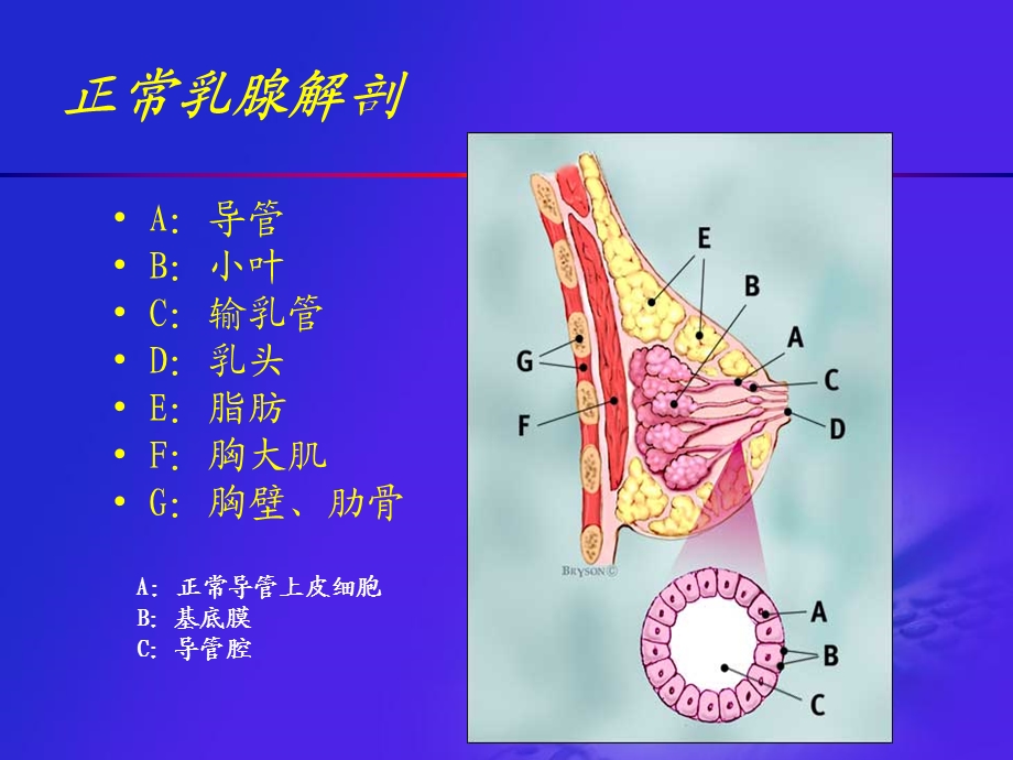 《乳腺疾病超声诊断》PPT课件.ppt_第3页