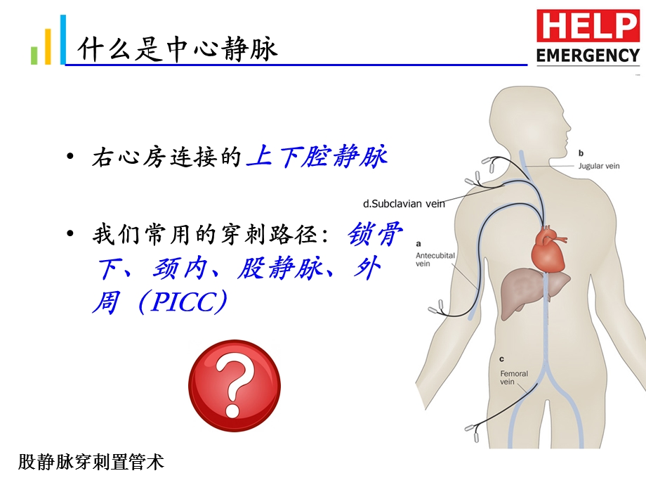 《股静脉置管术》PPT课件.ppt_第2页