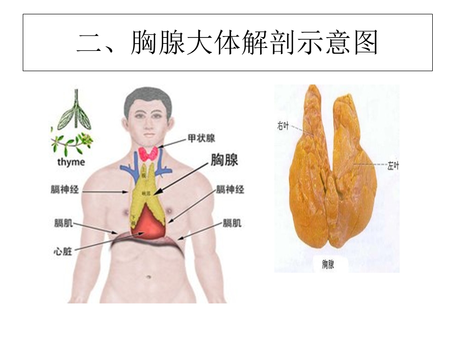 《胸腺瘤影像表现》PPT课件.ppt_第3页