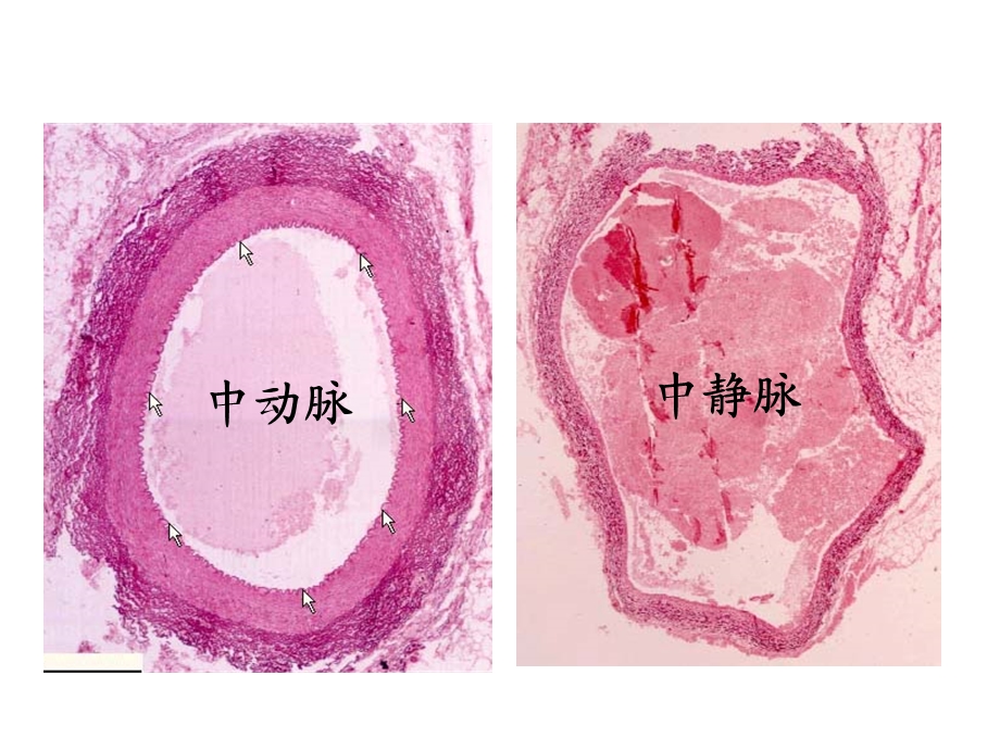 用静脉血管.ppt_第3页