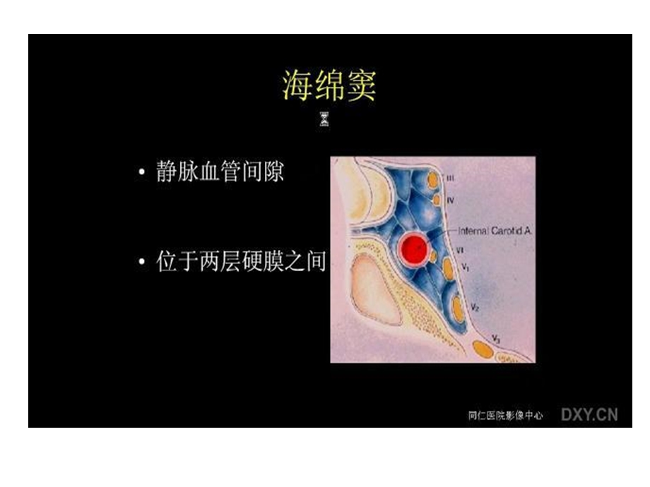 《海绵窦病变》PPT课件.ppt_第2页