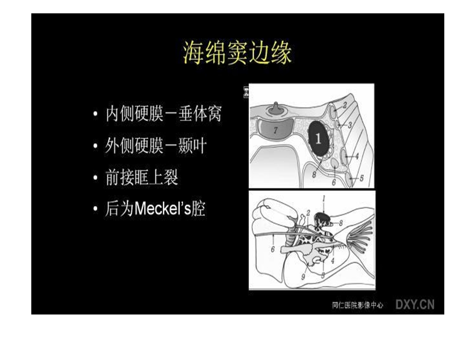 《海绵窦病变》PPT课件.ppt_第3页