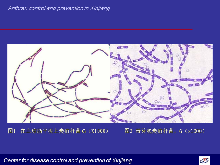 《炭疽处置刘清》PPT课件.ppt_第3页