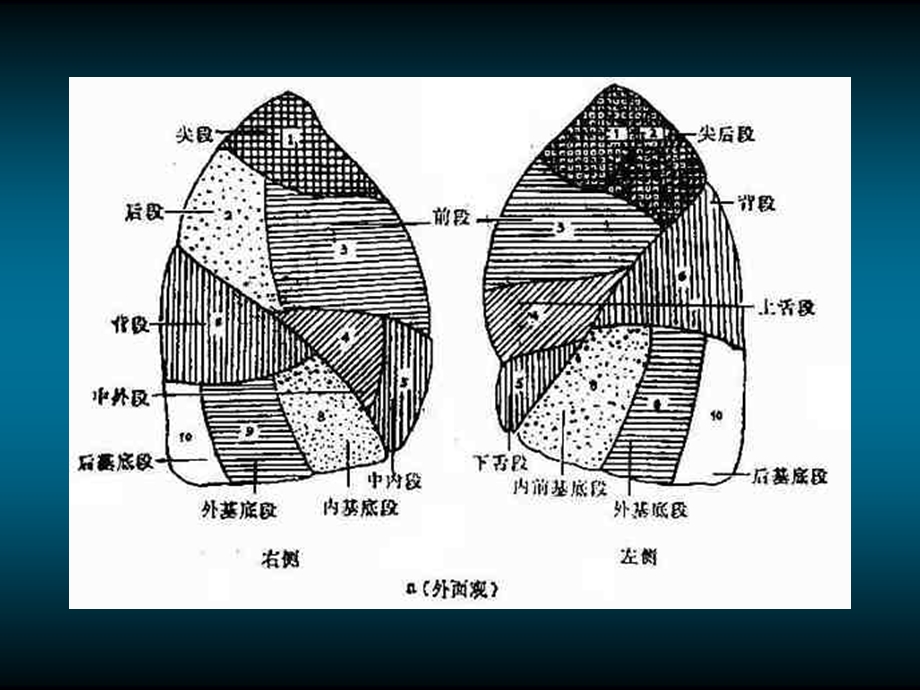 《肺的X线解剖》PPT课件.ppt_第3页