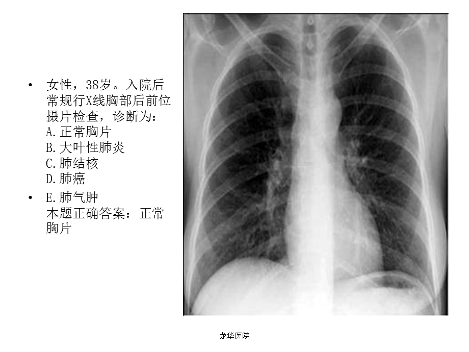 《X线读片习题》PPT课件.ppt_第2页