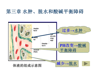 《水肿和脱水》PPT课件.ppt