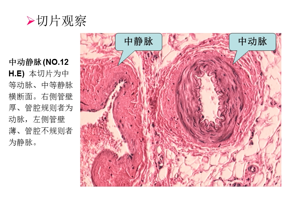 实验4.循环系统、免疫系统.ppt_第3页