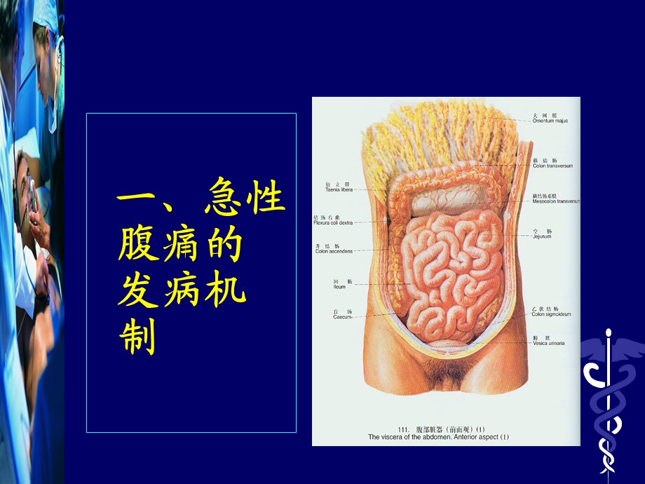 《腹痛诊治思维》PPT课件.ppt_第2页