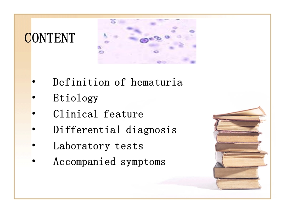 血尿Hematuria.ppt_第2页