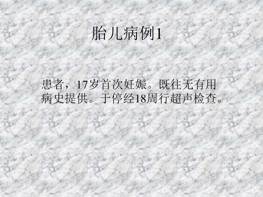 胎儿病例1.ppt_第1页