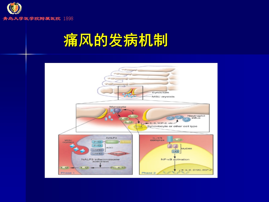 《痛风讲座》PPT课件.ppt_第3页