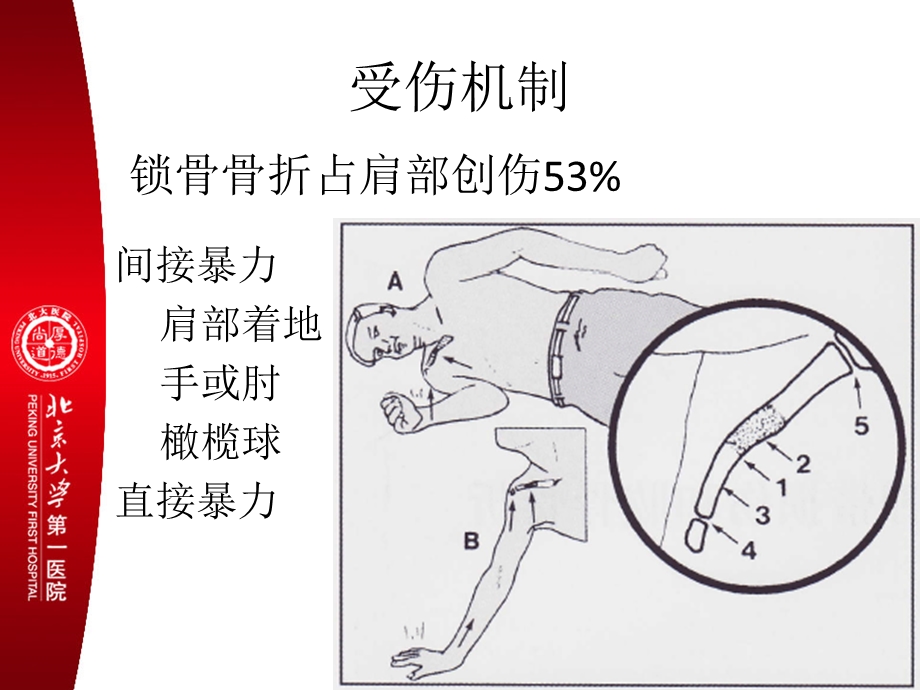 锁骨肩胛骨1.ppt_第2页